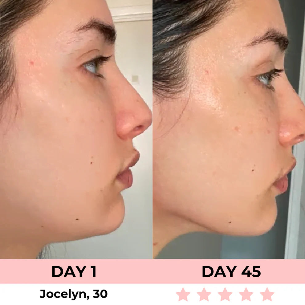 Booface Beauty™. Face and Neck Sculptor